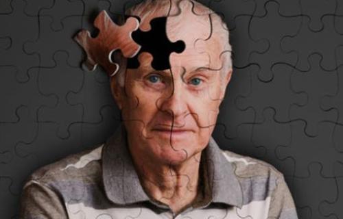 阿尔茨海默氏症是一种聚集疾病