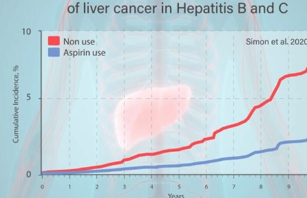 小剂量阿司匹林可降低肝癌风险