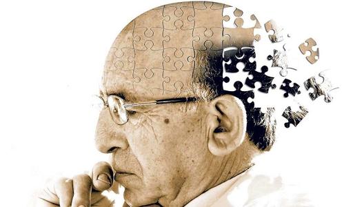 在症状出现之前大脑变化与阿尔茨海默氏症相关