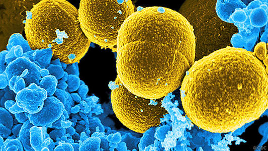 金黄色葡萄球菌应激蛋白的高分辨率晶体结构的解决方案