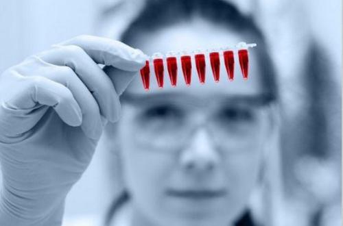 3D打印设备检测早产的生物标志物