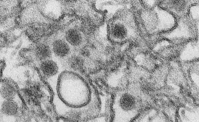 首次病毒基因组分析为巴西寨卡病毒爆发提供了新见解