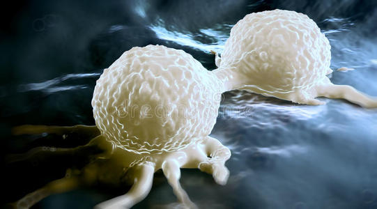 科学家阻止乳腺癌细胞扩散
