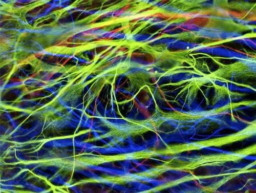 神经元干细胞3D打印到潜在植入物上