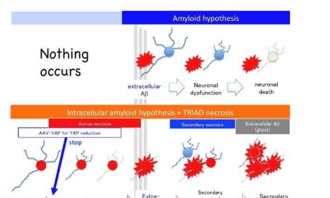 脑细胞死亡的时机揭示了阿尔茨海默氏症治疗的新目标