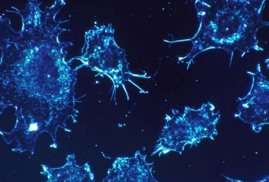 研究人员发现特定组蛋白脱乙酰基酶在非小细胞肺癌中的新作用