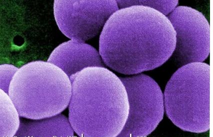 最新研究表明 最致命的超级细菌并不是最具毒性的