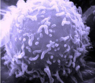 科学家修饰CAR-T细胞以靶向白血病细胞上的多个位点