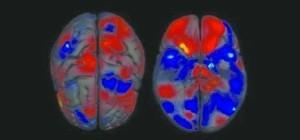 fMRI研究发现参加接触运动与非接触运动的运动员的大脑差异