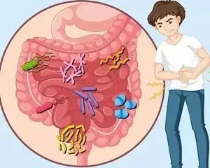与炎症性肠病和抑郁症相关的单一肠道肠型