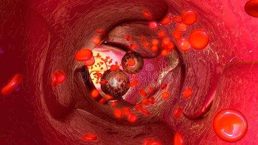 UIC研究人员发现血管细胞独特的器官特异性特征谱