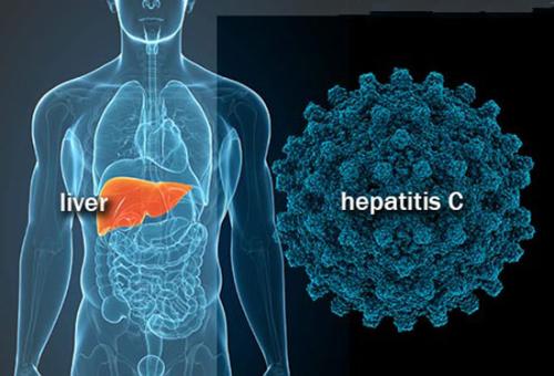 通过比较针头与蚊子新模型提供了对丙型肝炎解决方案的见解