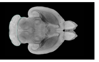 研究人员成功修复了中风受损的大鼠大脑