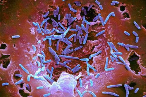 抗癌药可以杀死感染了疟原虫的肝细胞