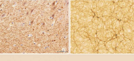 人类的大脑类似于宇宙吗