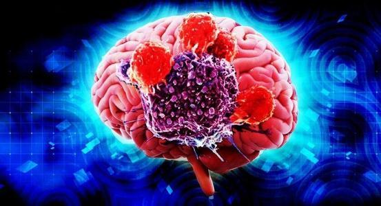 特拉维夫大学的突破研究可能会延长脑癌和卵巢癌患者的预期寿命