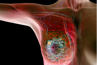 新技术通过眼泪检测出乳腺癌