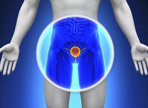 男性不育与前列腺癌风险增加有关