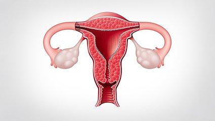 开发子宫内膜异位症的非侵入性测试