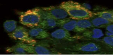 联合细胞发现为类风湿关节炎的改善治疗提供了线索