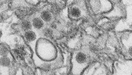 科学家描述了增强寨卡病毒研究的新研究模型