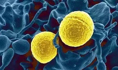 研究人员解开了超级细菌毒素对肠道的损害之谜