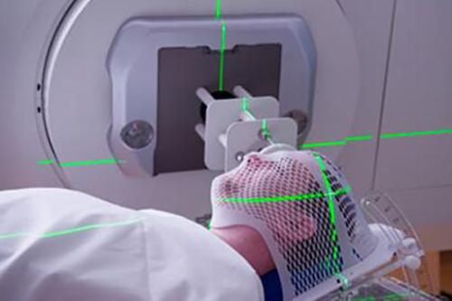 研究表明 慢性应激会影响放射疗法的疗效