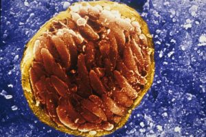 弓形虫病囊肿的电子显微镜图像在小鼠的脑中