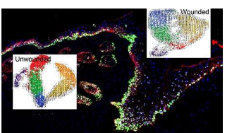 一项新研究揭示了皮肤细胞如何准备好治愈伤口