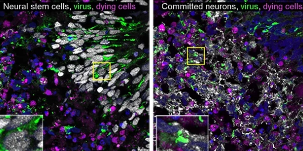 脑类器官为神经元杀伤病毒提供线索