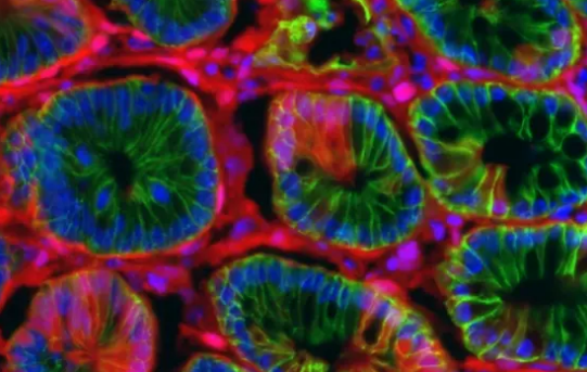 加速结肠癌研究的新模型