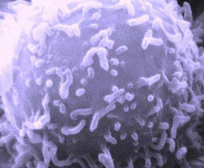针对某些快速分裂的癌细胞的新方法 使健康细胞不受伤害
