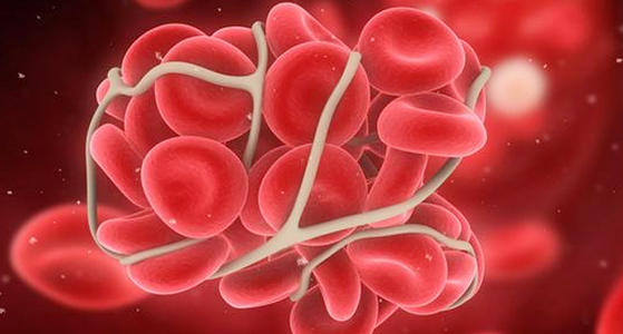 研究改变败血症管理的指导方针
