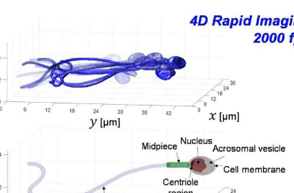 以最快的速度对精子细胞进行精确的3D成像可以改善IVF治疗