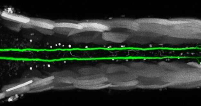 科学家发现神经元的非凡再生