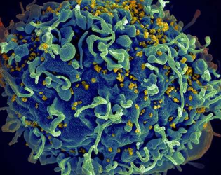 研究人员发现艾滋病毒如何从治疗中隐藏