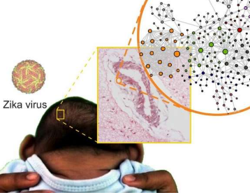 研究发现怀孕期间寨卡病毒感染如何影响胎儿大脑