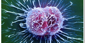 新模型可以解释为什么某些癌细胞对治疗有抵抗力