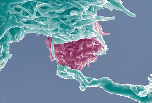 研究人员发现在肿瘤的治疗中微环境起着重要作用