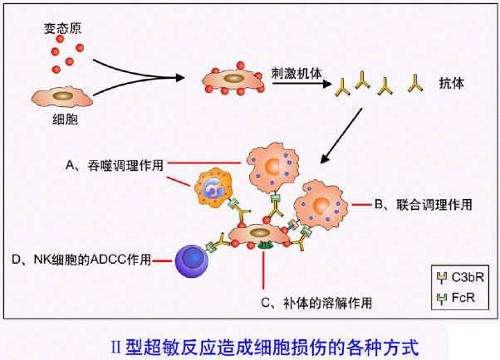 科普下常见Ⅱ型超敏反应性疾病有哪些