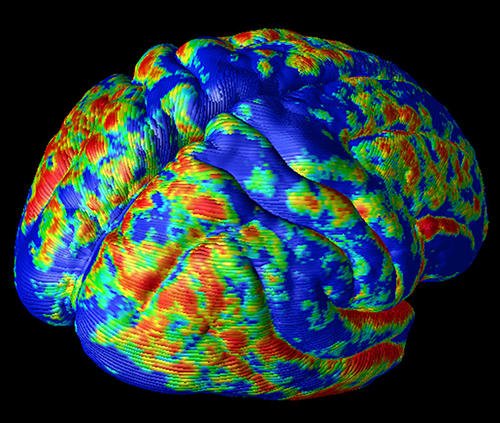 科学发现一种新的方式来理解大脑如何将无意识的信息转化为我们的意识