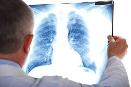 研究发现长期暴露于空气污染与肺气肿之间存在联系