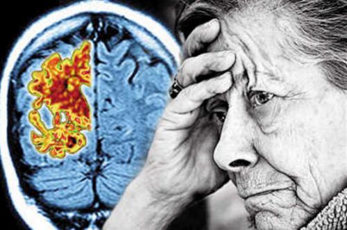 在阿尔茨海默氏症的研究中科学家将饥饿激素与记忆联系起来