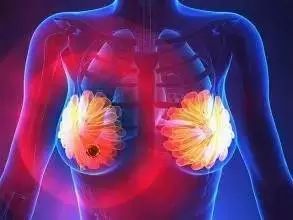 乳腺癌患者的治疗方法可能会立即推广到临床试验