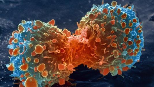 细胞降解中心的改变可能导致癌症