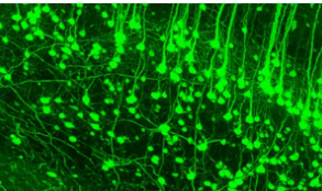 新的通用成像技术使研究人员能够追踪整个神经细胞的轨迹