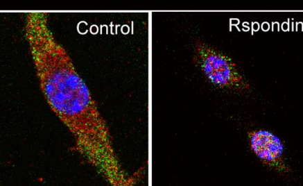 重新编程免疫细胞以减少炎症 促进组织修复