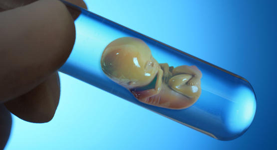 人类胚胎中的干细胞出奇地致力于专业化