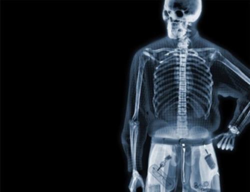 X射线现在也可以告诉我们有关软组织的信息