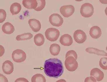介绍下网织红细胞和红细胞的超微结构是什么